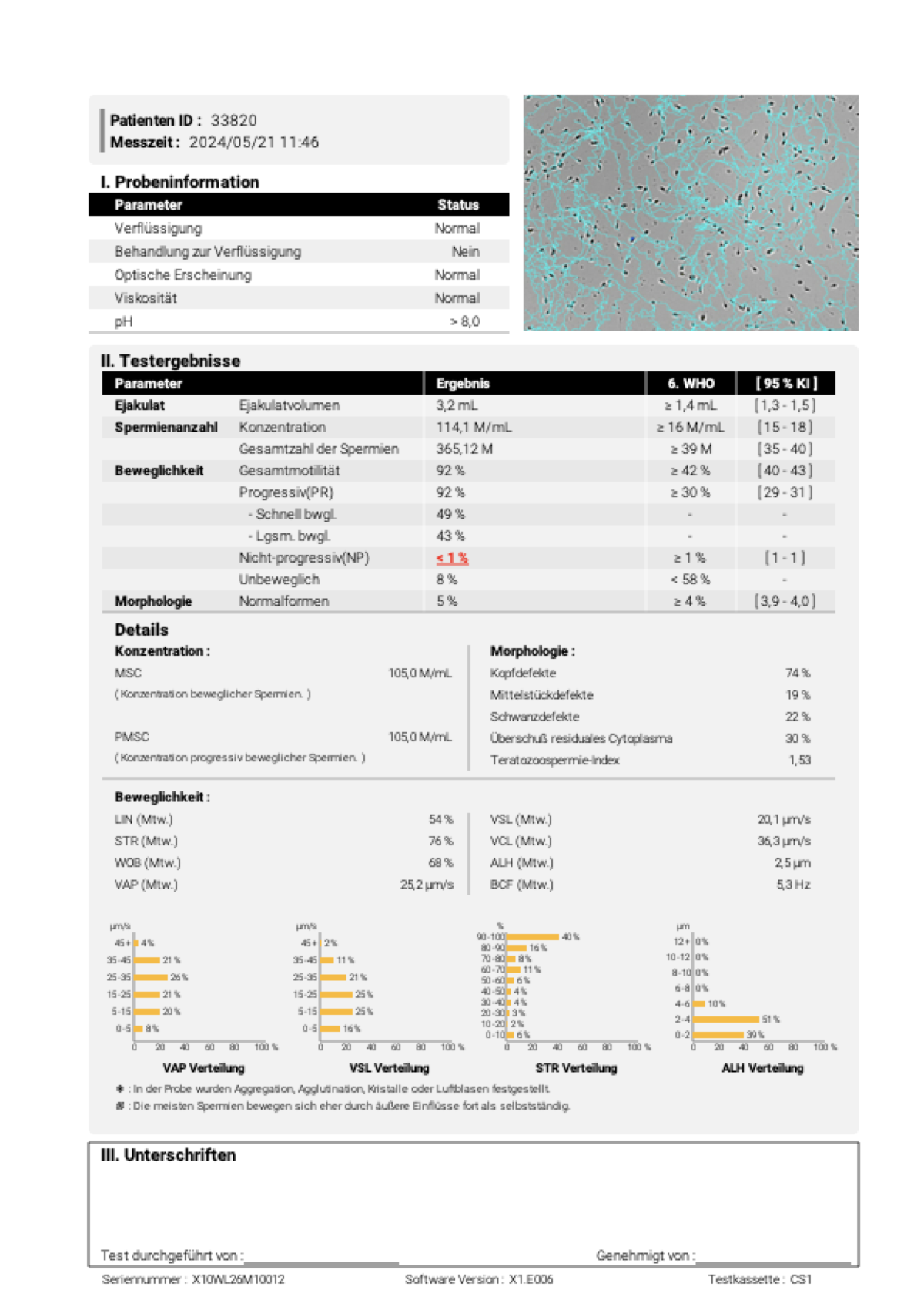 LensHooke X3 PRO · Beispiel-Befund Motilität 89 %